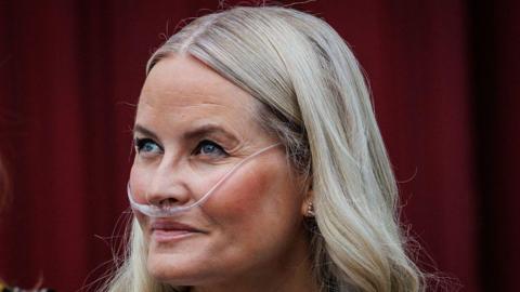 Norway’s Crown Princess Mette‑Marit Undergoes Successful Lung Transplant