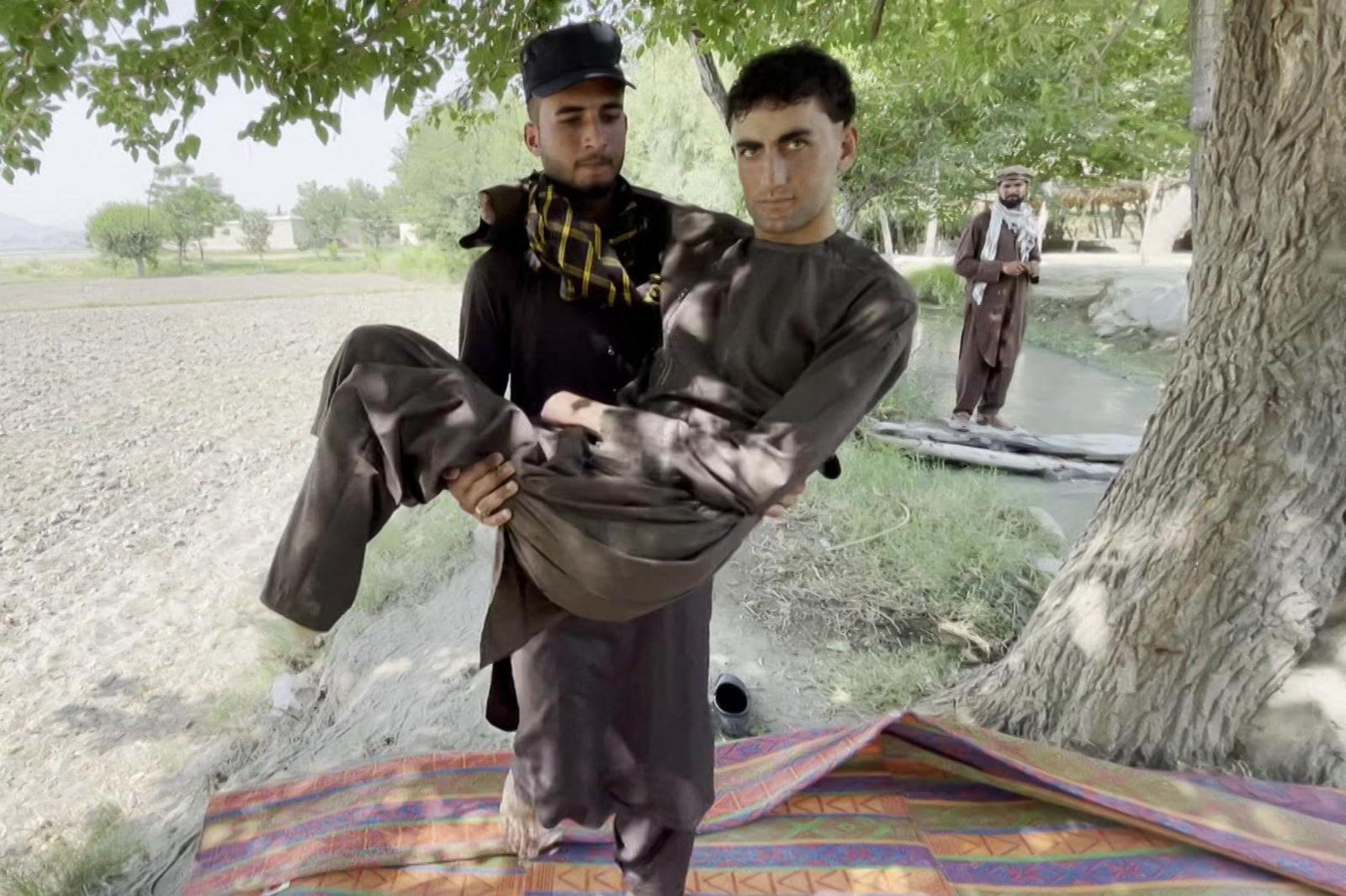 Turkish Border Guards Beat Afghan Migrants with Iron Rods, Causing 12 Amputations After Frostbite