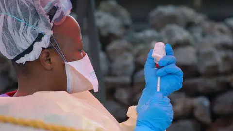 Ebola Outbreak Claims 80 Lives in Eastern DRC