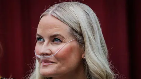 Norway's Crown Princess Undergoes Successful Lung Transplant, Palace Says